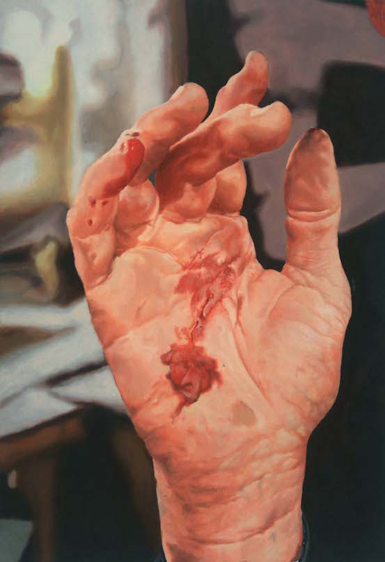 Painting of a white hand with a cut on the palm